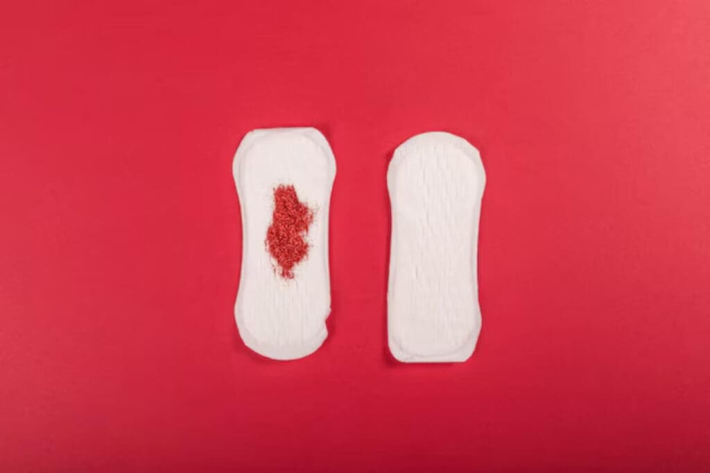 Featured image for How Much Blood is Normal During Your Period?